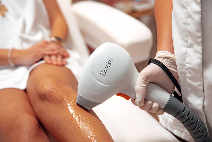 Epilation laser DIODE